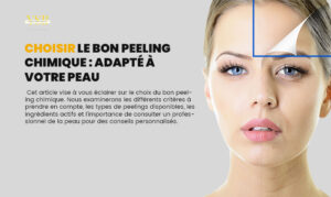 Choisir-le-Bon-Peeling-Chimique-yemak-santé-beauté